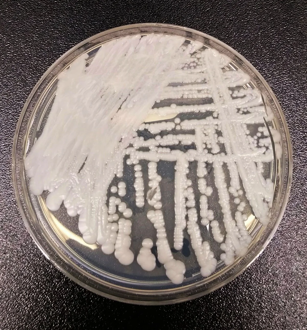 White streaks of yeast colonies growing across a round petri dish