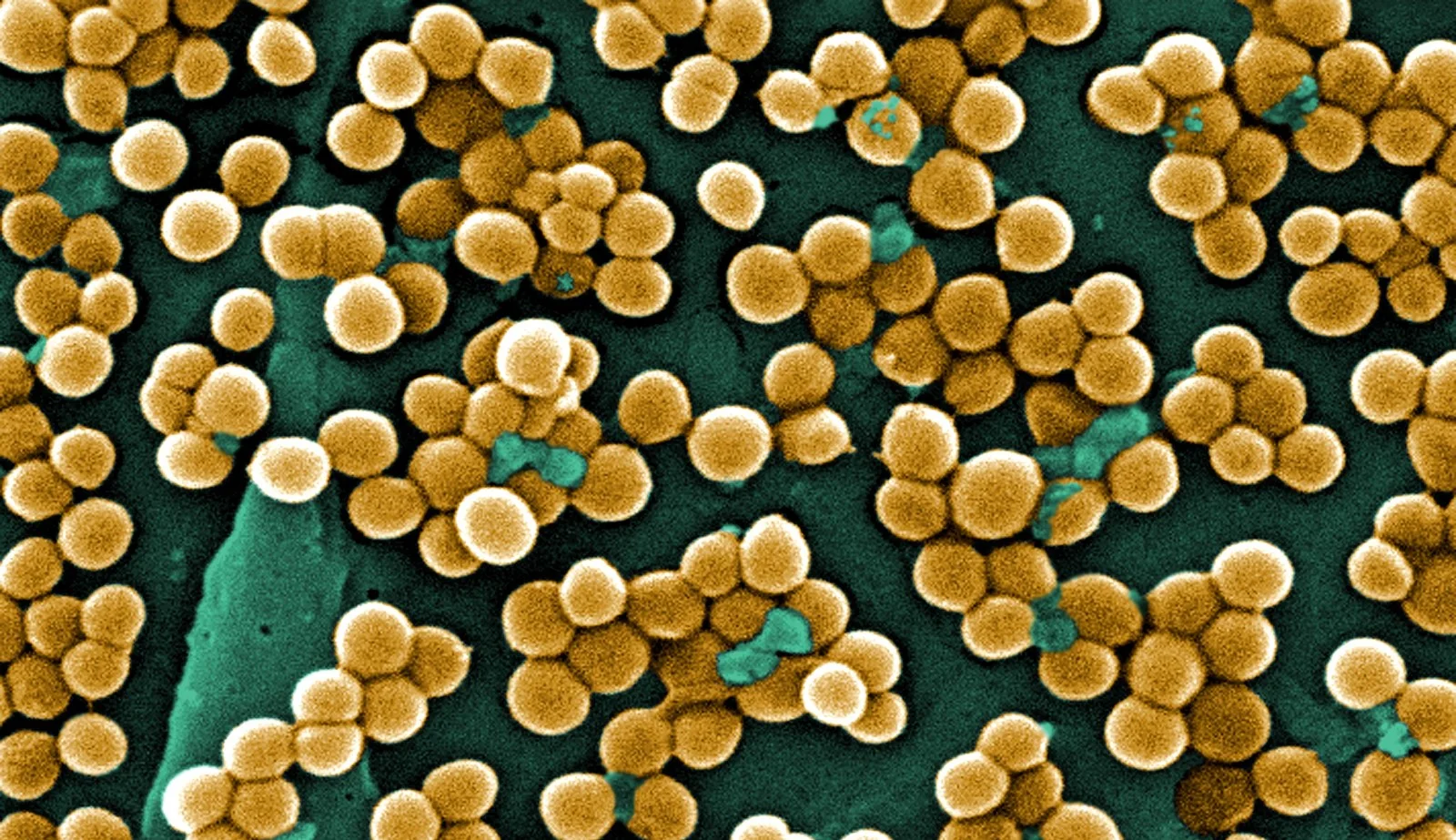 Colorized microscope image of round gold-colored bacteria in clusters on a teal background