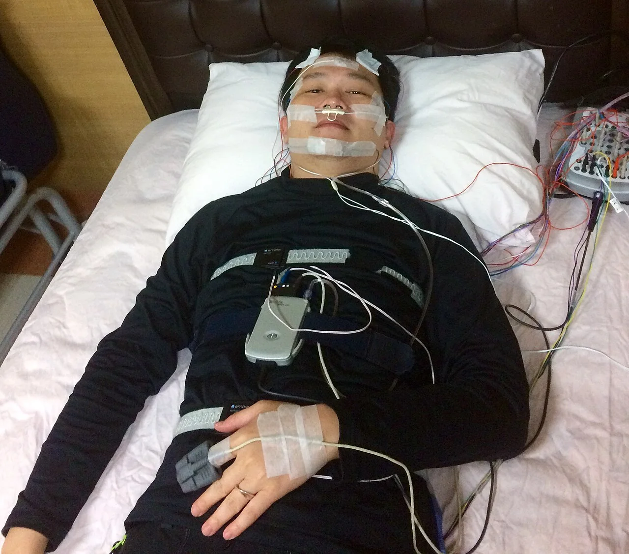 A person lying on a bed with sleep-study sensors attached to the face, chest and hand.