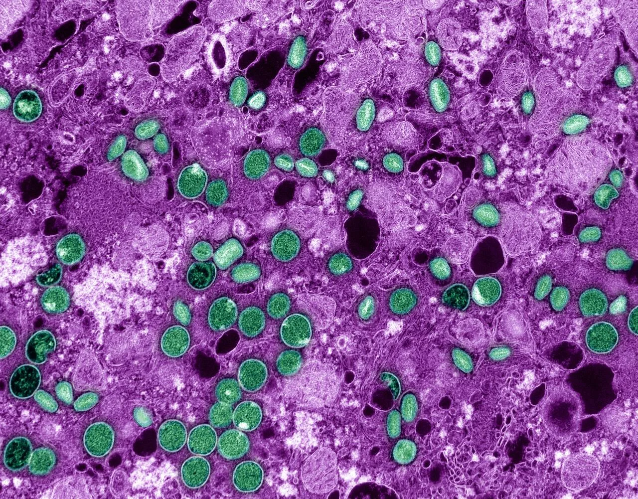 Colorized electron microscope image of green, oval mpox virus particles inside purple-tinted cells