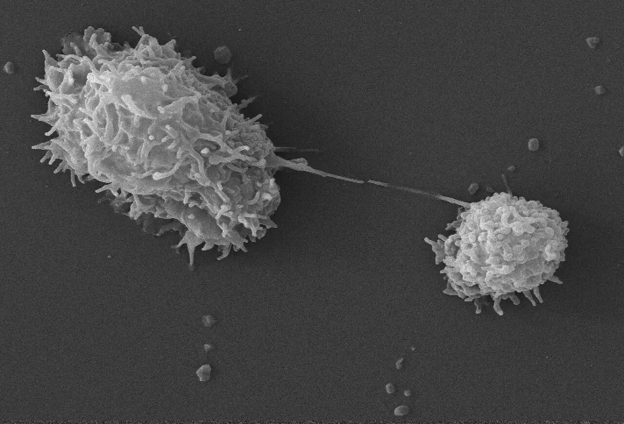 Black-and-white electron microscope image of two Acanthamoeba organisms with spiky surface projections touching each other