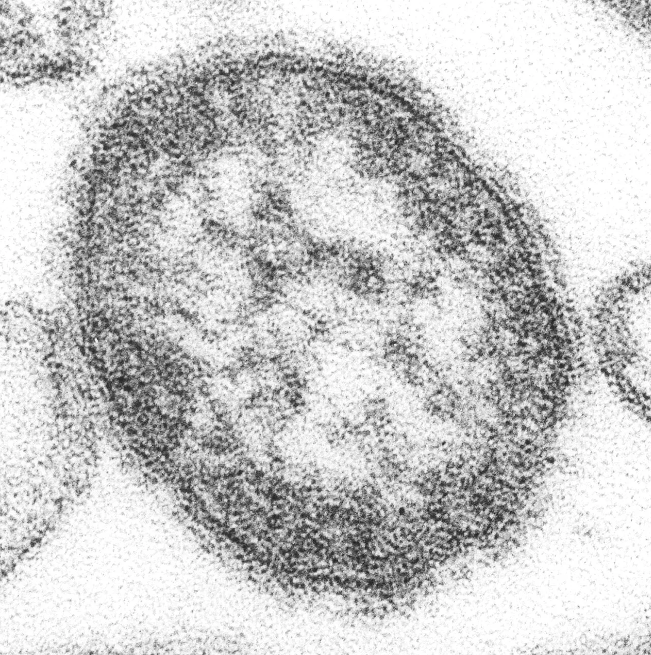 Black-and-white electron microscope image of a single round measles virus particle